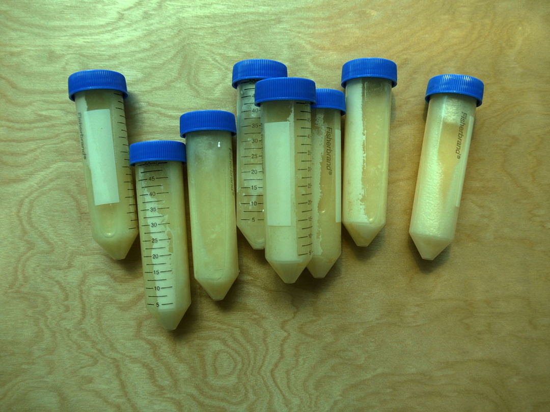 이소요_원형보존_A Dying Art_액침표본_가변크기_2016